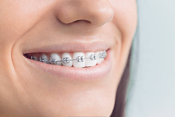 Best Full Mouth Reconstruction  in Ellenville, NY